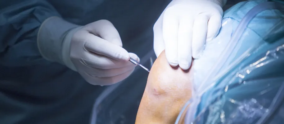 El DR. Ricardo Monge explica de forma sencilla los principales sintomas de la tendinitis que es un proceso agudo inflamatorio El DR. Ricardo Monge explica de forma sencilla los principales sintomas de la tendinitis que es un proceso agudo inflamatorio