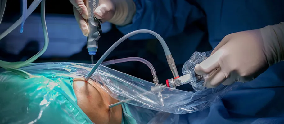 Imagen de fractura de tibia y peroné