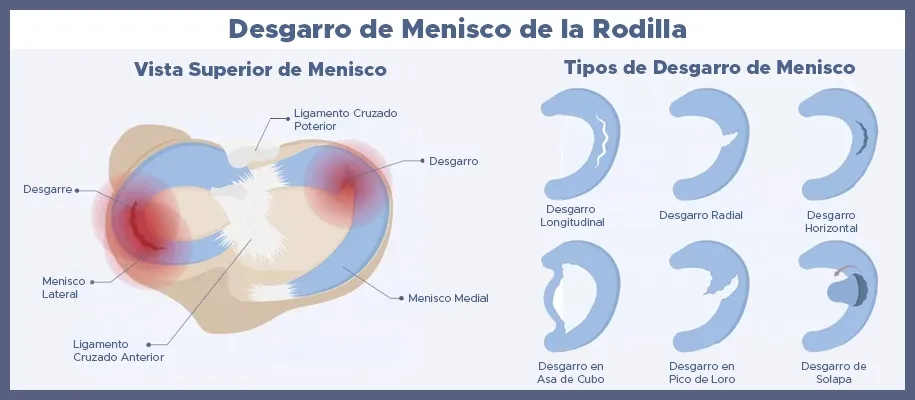 La mejor dupla ortopedica en Tijuana Dr Monge Ortopedista traumatologo La mejor dupla ortopedica en Tijuana Dr Monge Ortopedista traumatologo