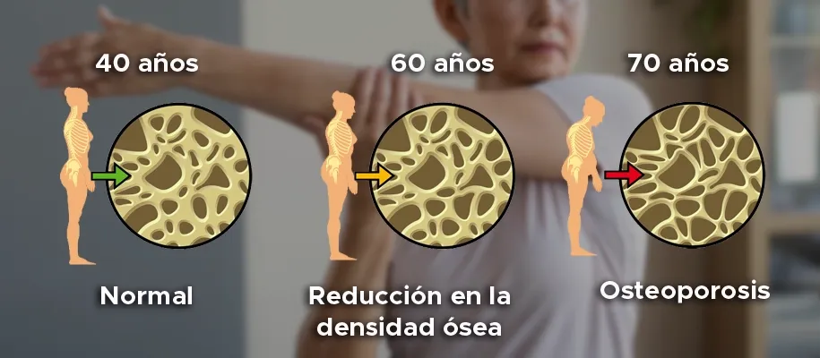 Desequilibrio Hormonal y tu Salud Ósea: ¿Cómo las Enfermedades Endocrinas Provocan Dolor en Huesos, Articulaciones y Músculos?