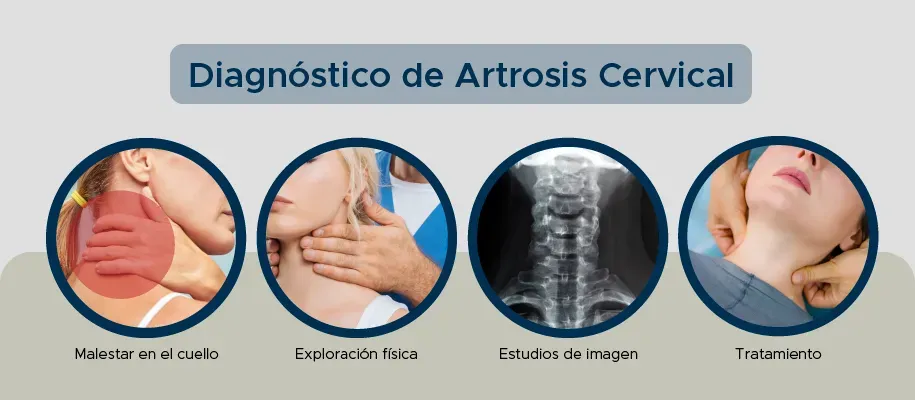 Dr. Monge explica los diagnósticos para una artrosis cervical Dr. Monge explica los diagnósticos para una artrosis cervical