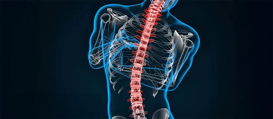 Guía Completa de las Etapas de Curación Ósea | Dr. Monge Ortopedia Tijuana Diagrama de las 4 fases de curación de fracturas del Dr. Monge - Inflamación, Callo Blando, Callo Duro, Remodelación