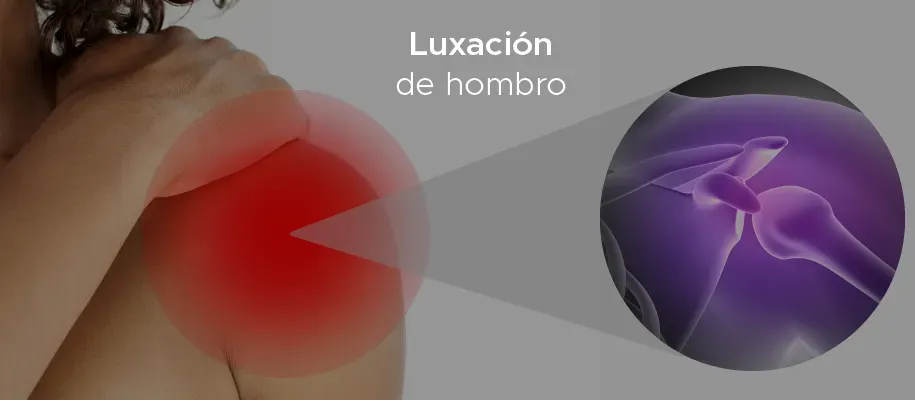 Diagrama que muestra la anatomía del codo y el procedimiento de artroscopia