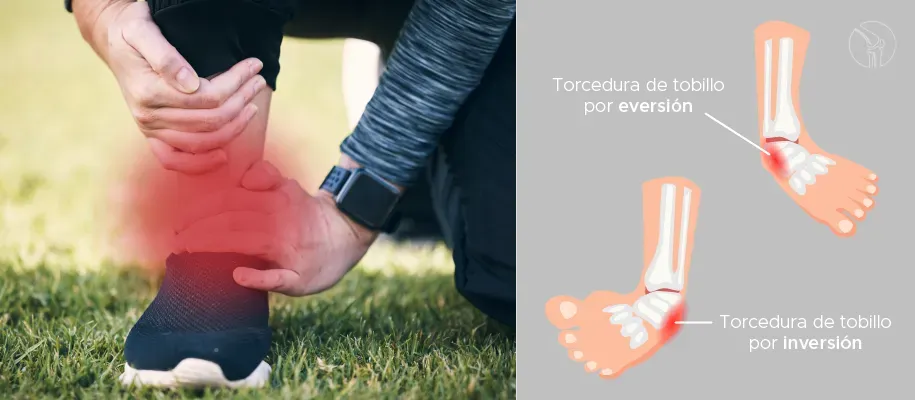 Como funciona el tobillo articulacion movimiento y estabilidad Como funciona el tobillo articulacion movimiento y estabilidad